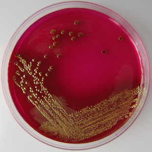 Zelf bacteriën kweken